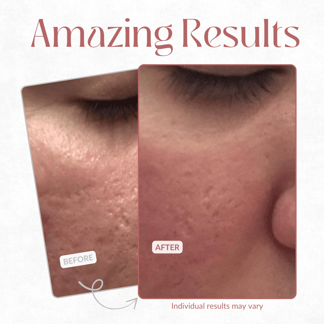 ✨KLARAG™Pore Relief Multi Balm – 🧴Cuts Shine, Smooths Texture, Makeup-Ready🌿
