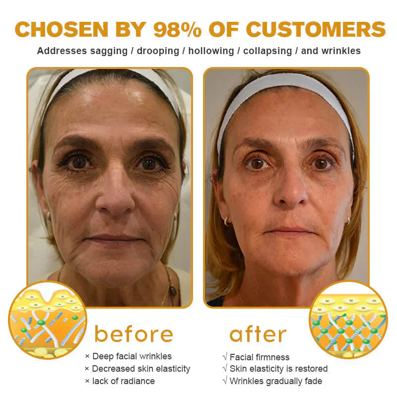🐝 Bee Venom “Liquid Botox” Serum —Smooth Wrinkles in 2 Mins, No Needles, Instantly Firm & Lift
