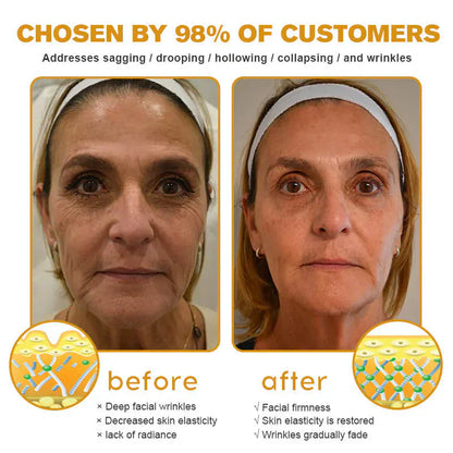 🐝 Bee Venom “Liquid Botox” Serum —Smooth Wrinkles in 2 Mins, No Needles, Instantly Firm & Lift