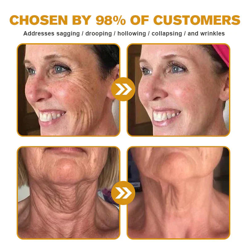 🐝 Bee Venom “Liquid Botox” Serum —Smooth Wrinkles in 2 Mins, No Needles, Instantly Firm & Lift