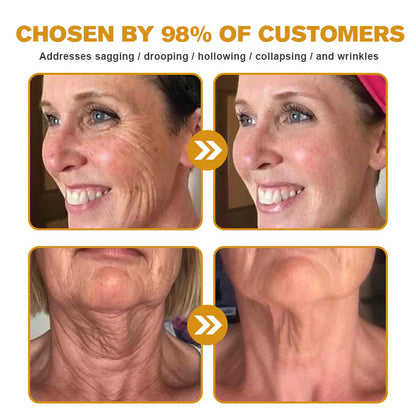🐝 Bee Venom “Liquid Botox” Serum —Smooth Wrinkles in 2 Mins, No Needles, Instantly Firm & Lift