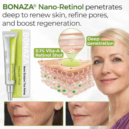 🧬🔬Micro-Spicule Firming Cream —Visible Results in 3 Days, No Needles