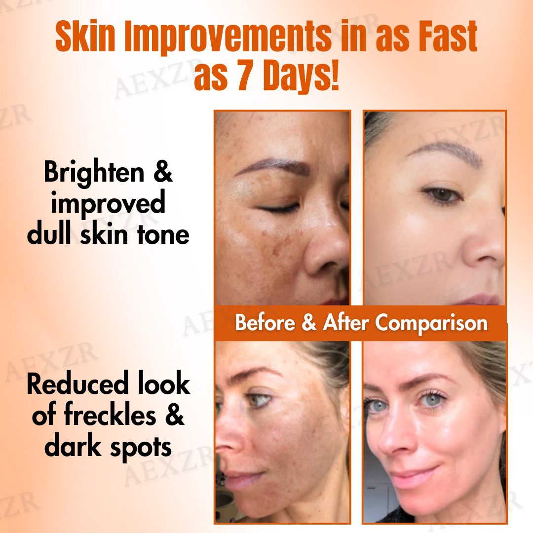 💧🍊 Skinetiv™ TripleAction Vitamin C Cream | Fade Freckles in 7 Days, Brighten & Even Skin Tone (Copy)
