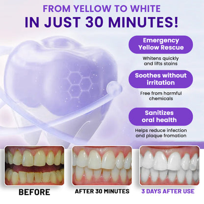 🦷 AEXZR® V34 Whitening Strips —Visible Results in 30 Minutes, No-Slip Design, Enamel-Safe & Sensitivity-Free