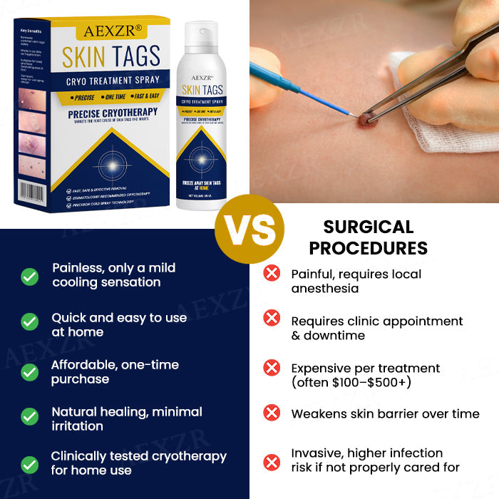🏆 Advanced Skin Tag & Wart Remover Spray — Freeze Away Unwanted Growths Painlessly at Home! ✨