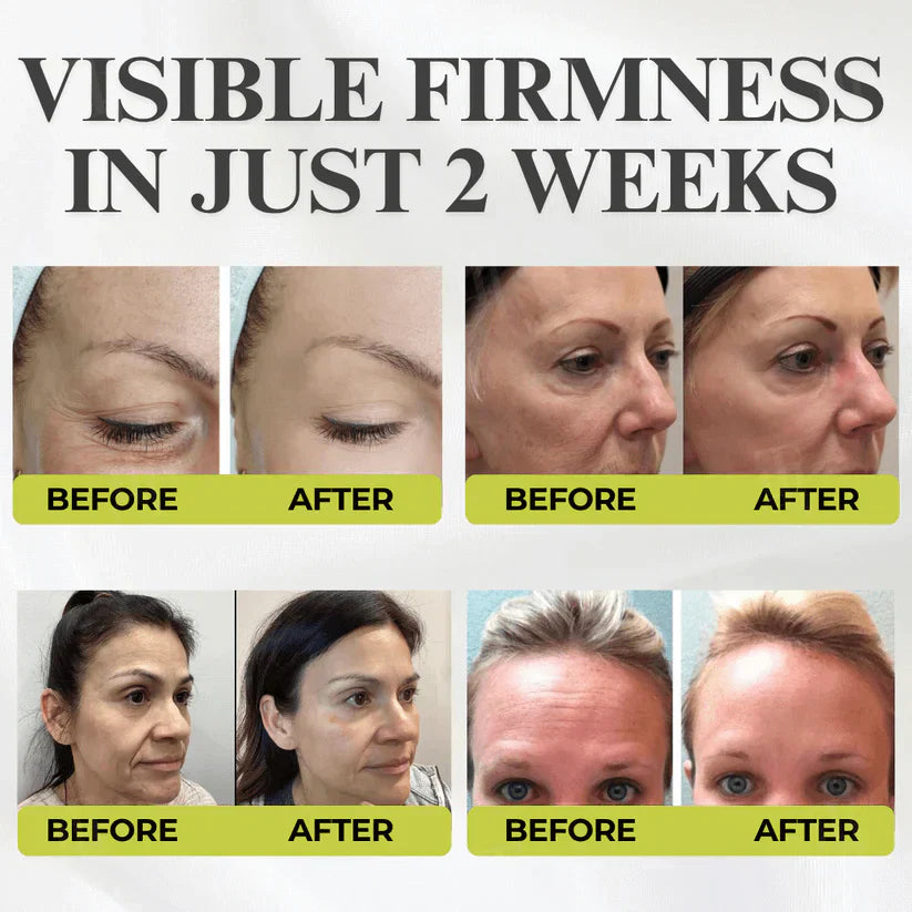 🧬🔬Micro-Spicule Firming Cream —Visible Results in 3 Days, No Needles