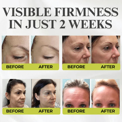 🧬🔬Micro-Spicule Firming Cream —Visible Results in 3 Days, No Needles