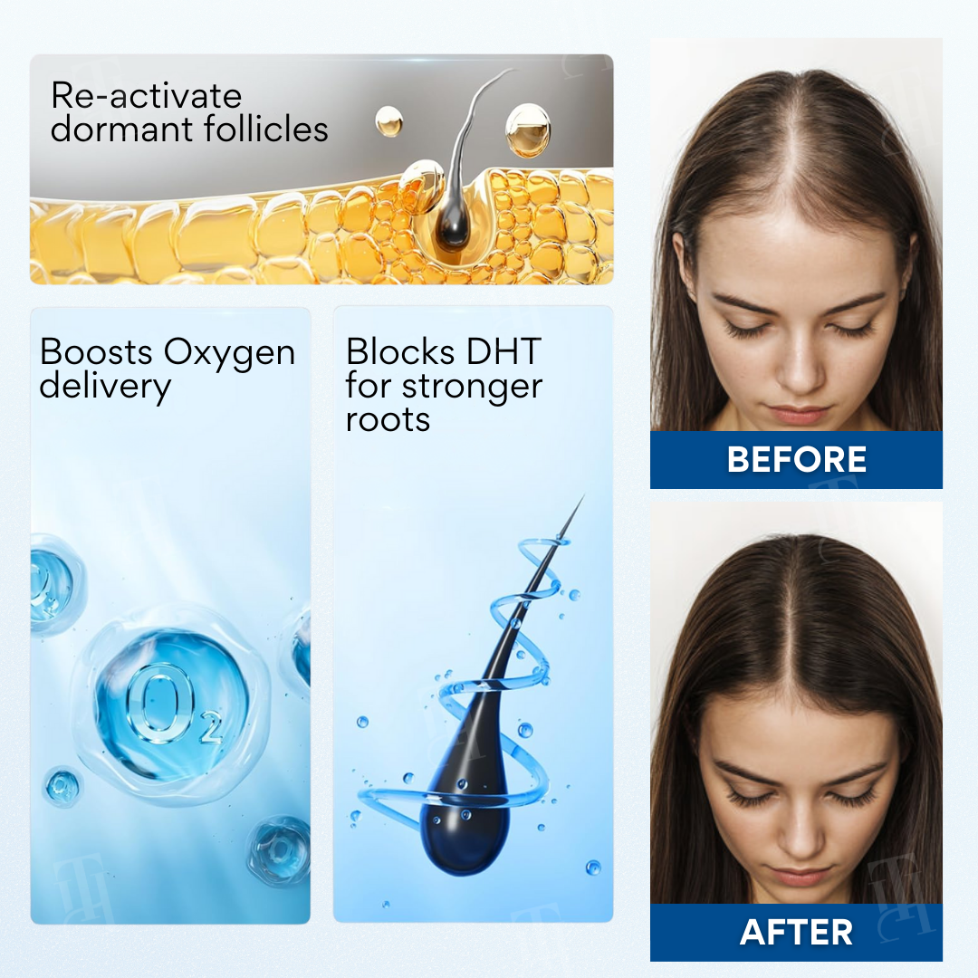 🌱🌿NeuroRoot Reset Roll-On Serum —Wake Up Dormant Follicles in 14 Days, Target Thinning at the Source )