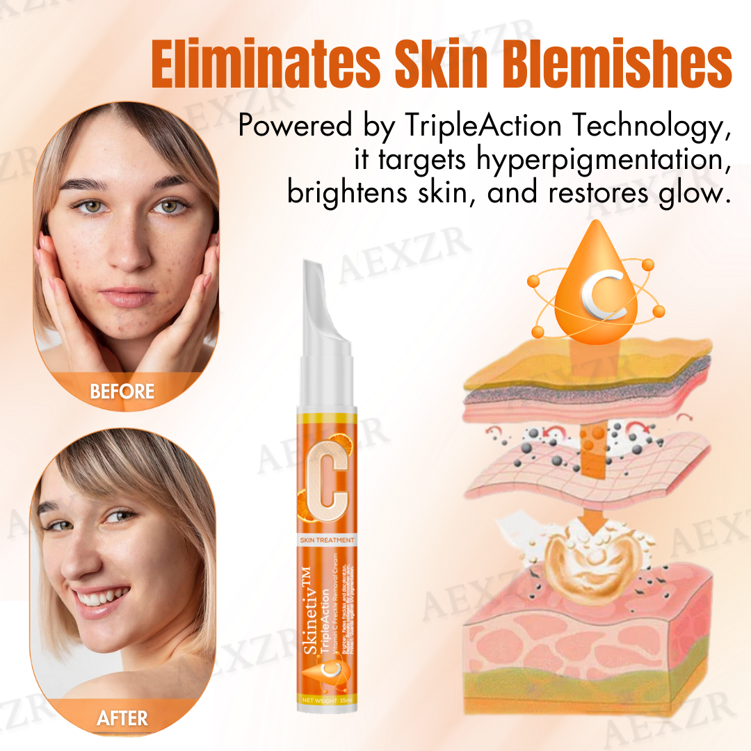 💧🍊 Skinetiv™ TripleAction Vitamin C Cream | Fade Freckles in 7 Days, Brighten & Even Skin Tone (Copy)