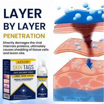 🏆 Advanced Skin Tag & Wart Remover Spray — Freeze Away Unwanted Growths Painlessly at Home! ✨