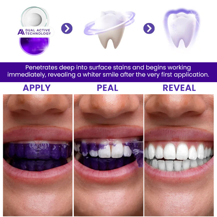 🦷 AEXZR® V34 Whitening Strips —Visible Results in 30 Minutes, No-Slip Design, Enamel-Safe & Sensitivity-Free