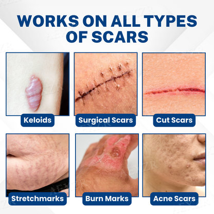 🌿 ScarPhix™ Scar Removal Cream —Clinically Proven to Fade Scars, Restore Smooth Skin