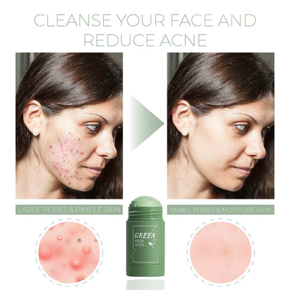 🍵 DeepPurifying Green Tea Clay StickMask - Draws Out Blackheads, Unclogs Pores in 15