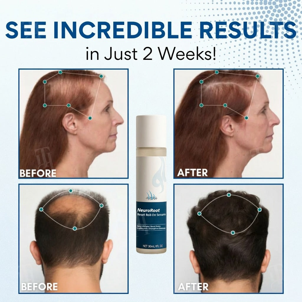🌱🌿NeuroRoot Reset Roll-On Serum —Wake Up Dormant Follicles in 14 Days, Target Thinning at the Source )